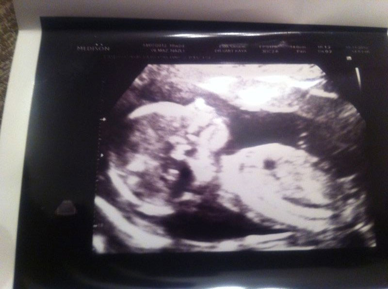 IMG_1703 Kıbrıs Tüp Bebek Merkezi